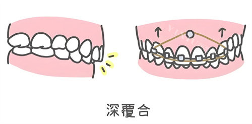 智齿动画图片