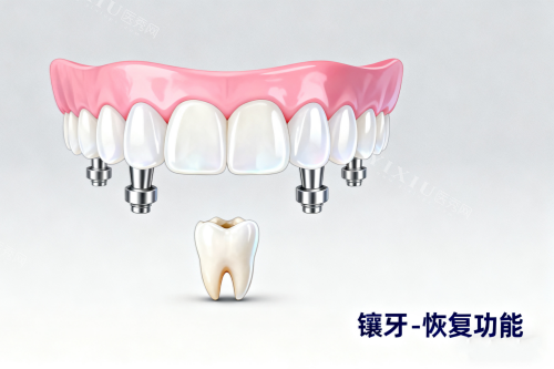 镶牙卡通图片一览