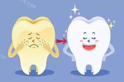 冷光美白前后对比动画图