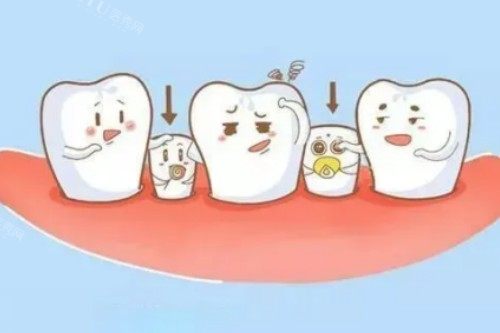 小孩子乳牙滞留卡通图