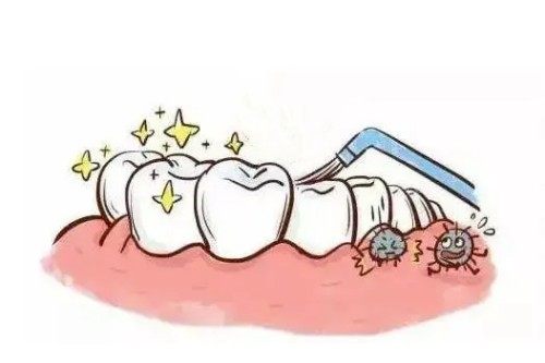 儿牙涂氟卡通图片展示