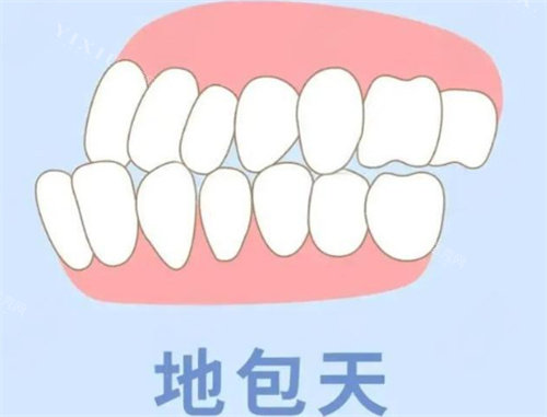 地包天动画展示图