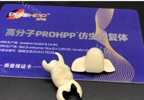 hpp粘接桥牙齿单颗示意图