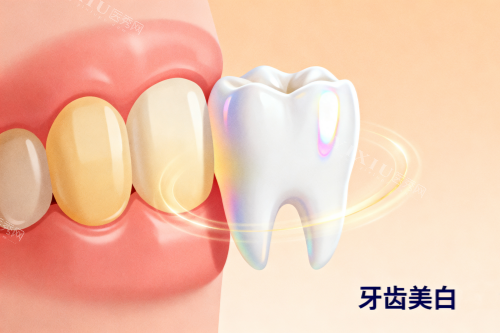 牙齿美白前后对比展示图