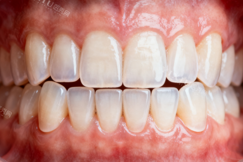 上海七宝矫正牙齿必收藏！10家矫正结果堪比整容的牙科清单，牙友说复诊超方便，悄悄变漂亮不是梦~(图10)