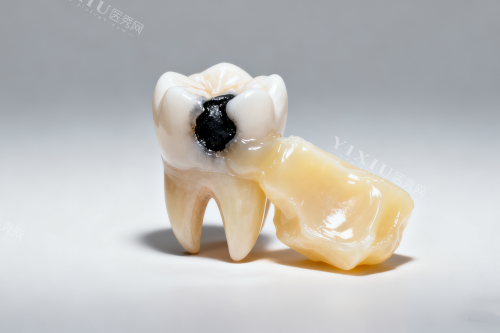 牙齿发黑卡通图片一览