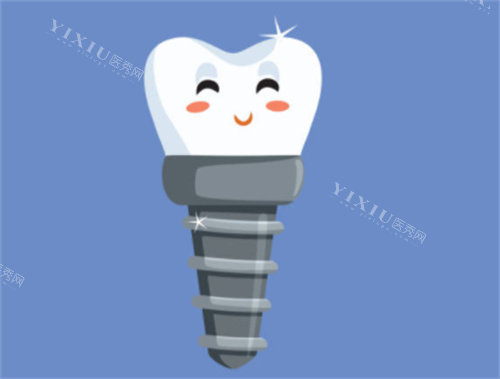 健康种植牙卡通图