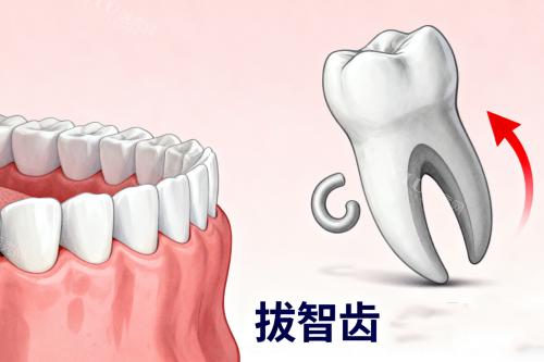 拔智齿卡通一览图