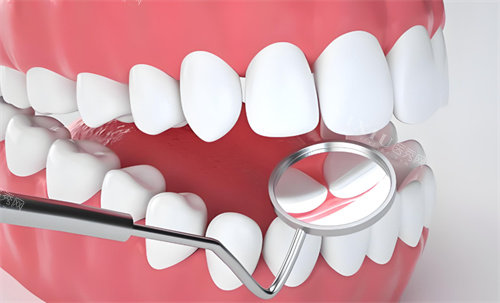 牙齿检查动画展示图