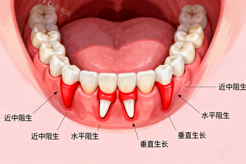 各类型智齿卡通图
