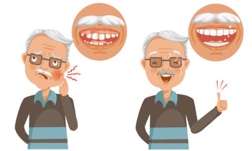 老人缺牙示意图