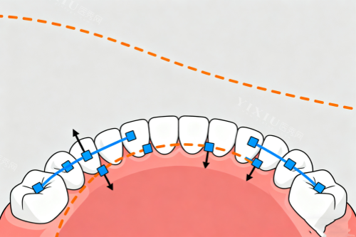 牙齿矫正概念图