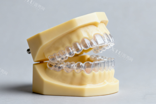 隐形矫正器模型展示图