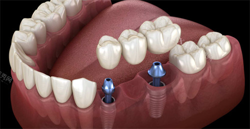 兰州万博口腔LOGO墙