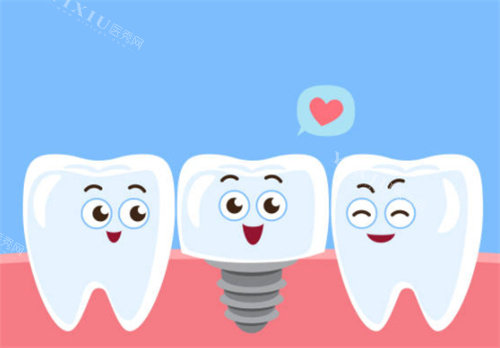 种植牙和健康的牙齿