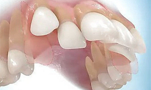 牙齿突兀卡通图