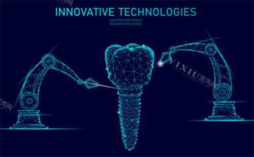 种植牙科技检查示意图