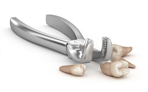 拔牙展示图卡通