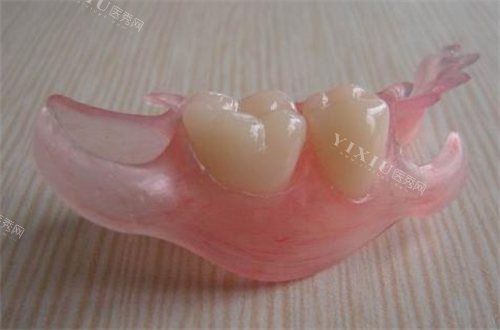 两颗活动假牙示意图
