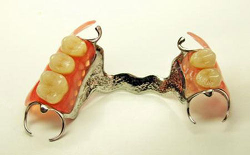 活动假牙示意图