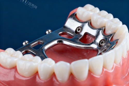 全口假牙模型展示