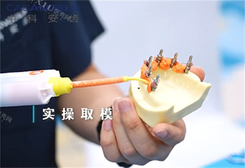 中科安齿种植牙实操取模