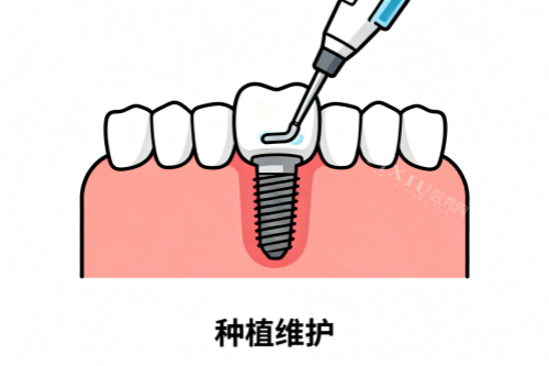 种植牙维护卡通图