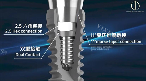 韩一种植牙材料展示照片