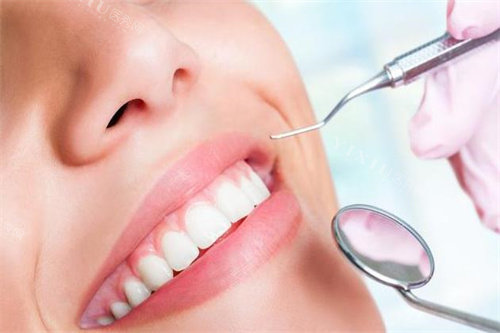 牙齿检查宣传图展示