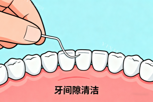 牙齿间隙清洁卡通图