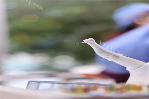 单颗牙齿贴面图