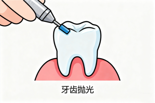 牙齿抛光卡通图