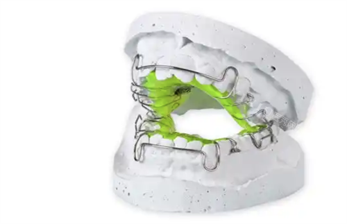 牙齿矫正扩弓器