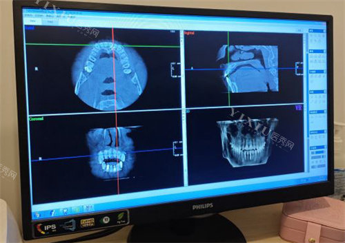 北京雅德嘉口腔牙齿拍片