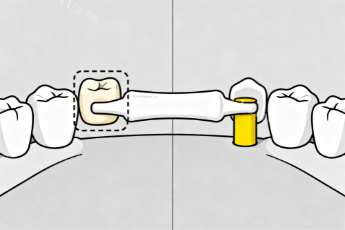 镶牙卡通展示图