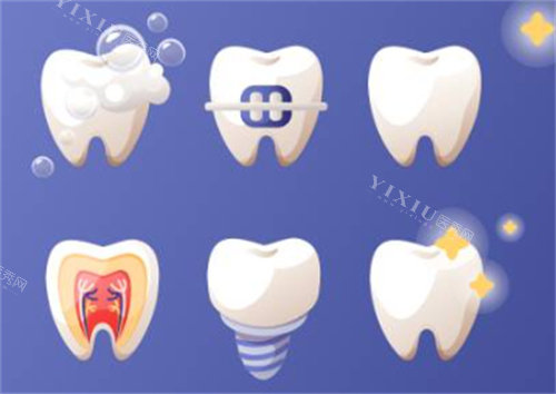 牙齿的各个项目