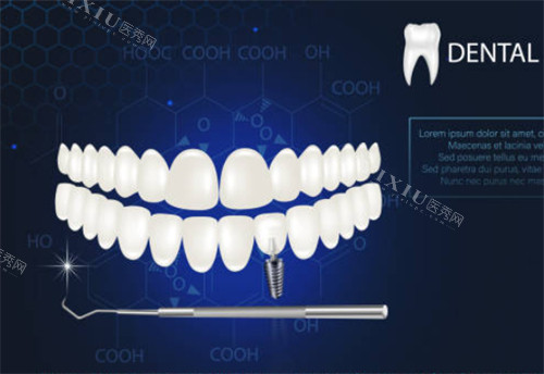 牙齿卡通图示CJ图