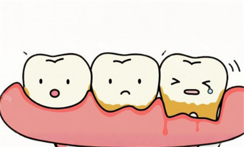 牙周炎动画图