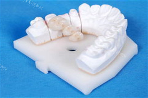 牙齿模型图片展示