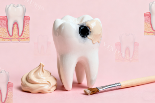 牙齿蛀牙修复卡通展示图