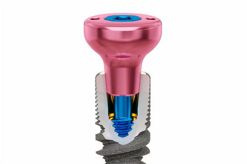 种植牙愈合基台透视图