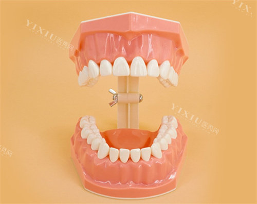 牙齿美白卡通图