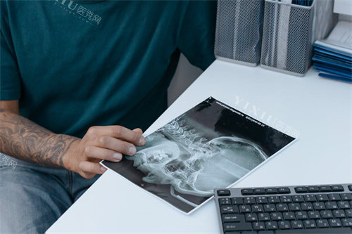 牙齿拍片后的沟通