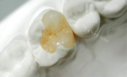 牙齿疼痛示意图