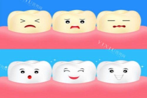 牙齿美白卡通展示