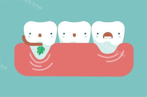 牙齿治疗过程卡通图