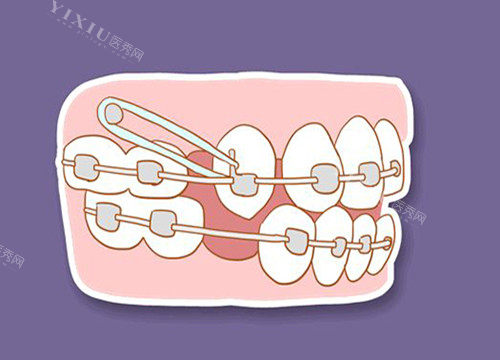 牙齿收缝卡通图片