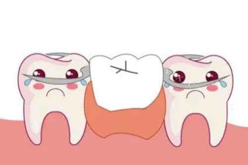 活动假牙安装卡通图