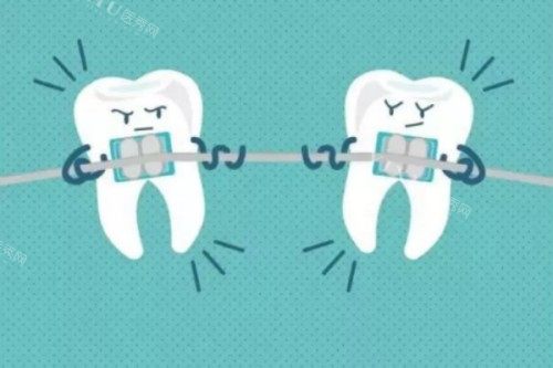 牙齿矫正卡通图