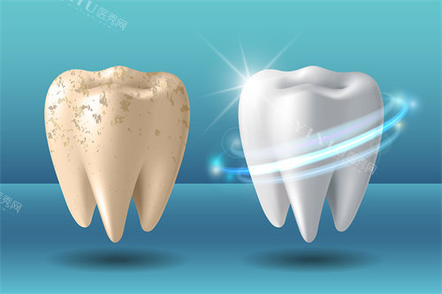 牙齿美白前后差异